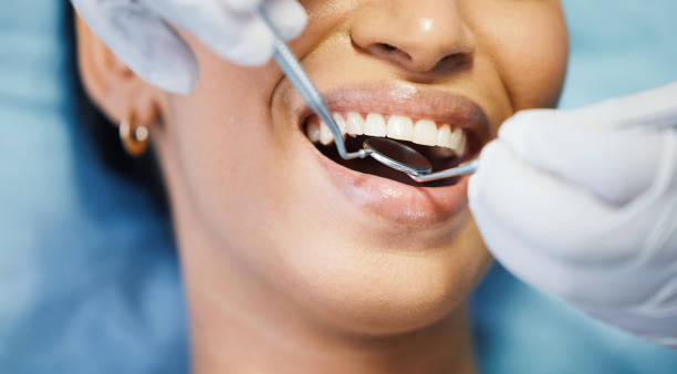 Best Emergency Wisdom Teeth Removal in Wilmington Island, GA