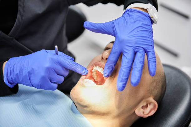 Best Emergency Wisdom Teeth Removal in Wilmington Island, GA